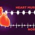 8 Silent Signs You May Have Heart Murmur