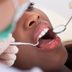 Dentists Reveal the Worst Ways to Whiten Your Teeth