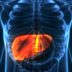 9 Silent Signs of Liver Cancer You Shouldnâ€™t Ignore