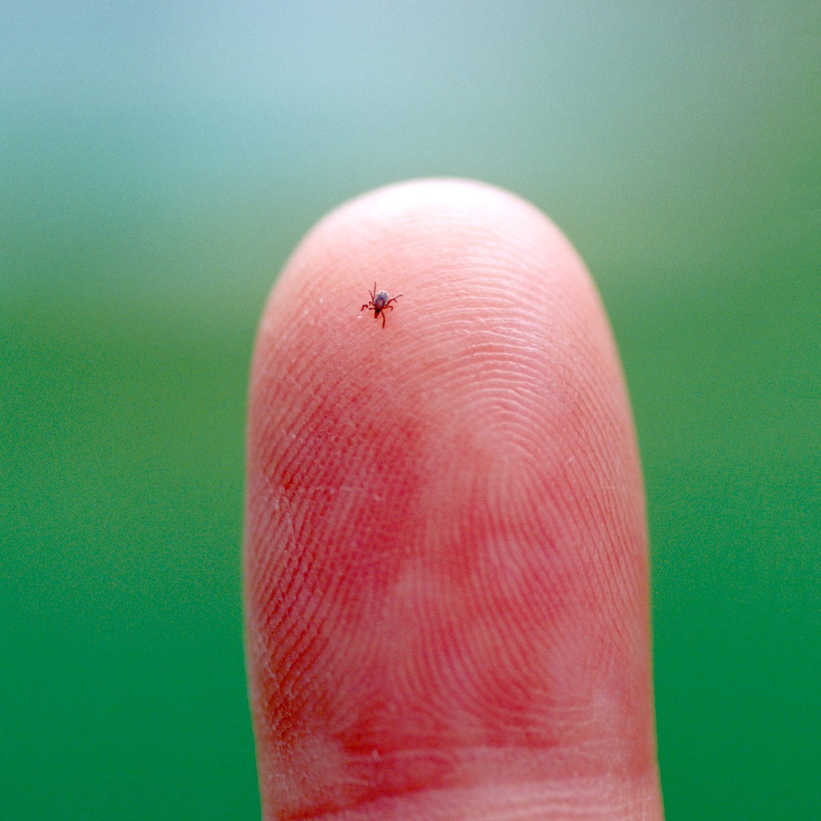 Here’s Why There Are So Many Ticks This Summer, Say Experts