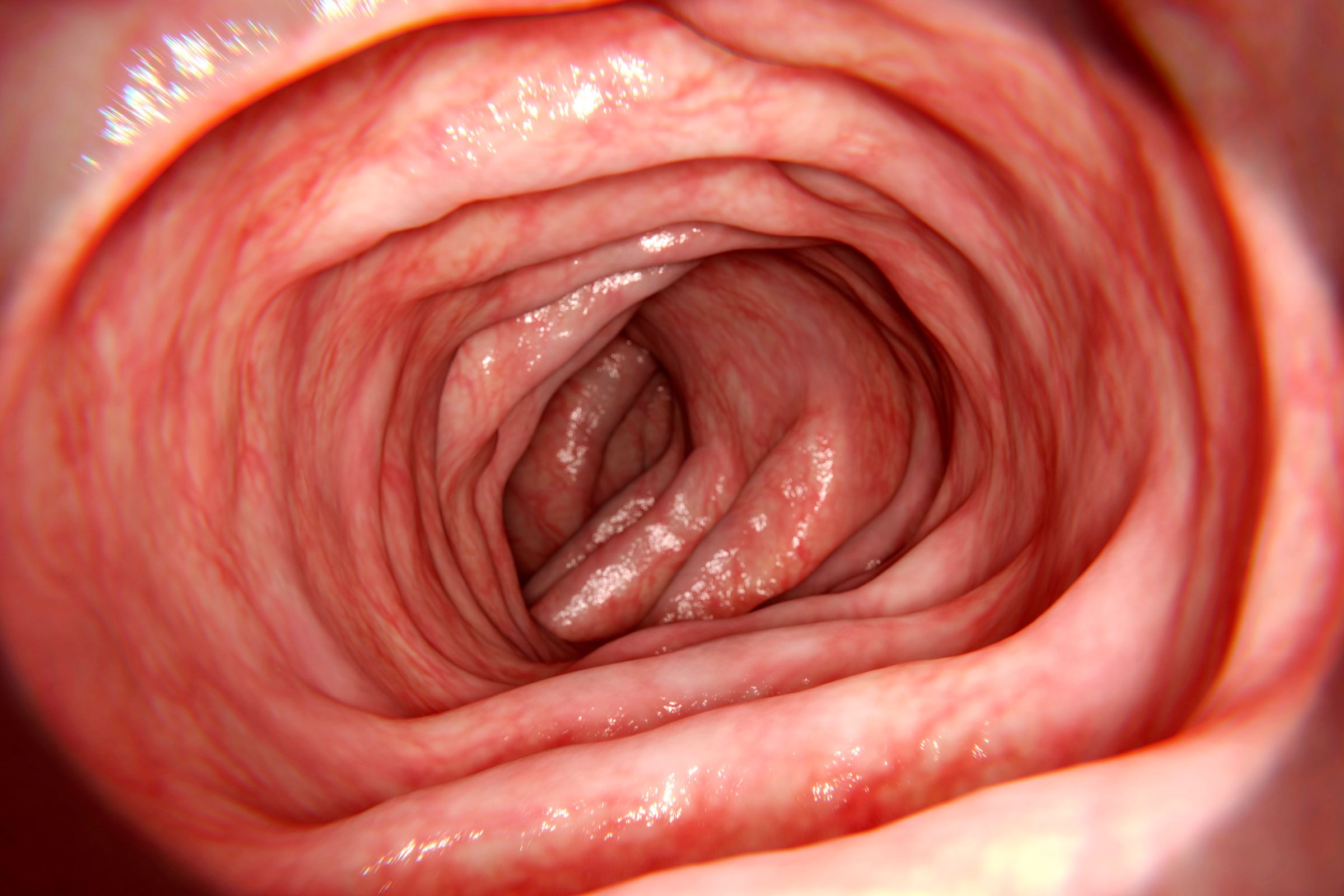 New Data: 80% of Americans Don’t Know This Colon Cancer Risk